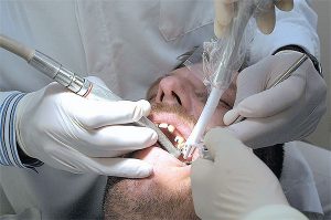 FAQS Dental emergency Room