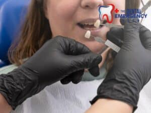 Dentist matching veneers to address tooth discoloration